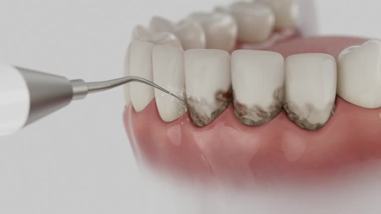 Reliable Dental contractor in Beacon Hill, WA by Dentist Open Now